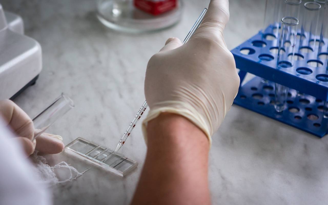 Laboruntersuchungen auf das Vorhandensein von Coronavirus COVID-19. Bluttest im Krankenhaus. Medizinische Ausrüstung.