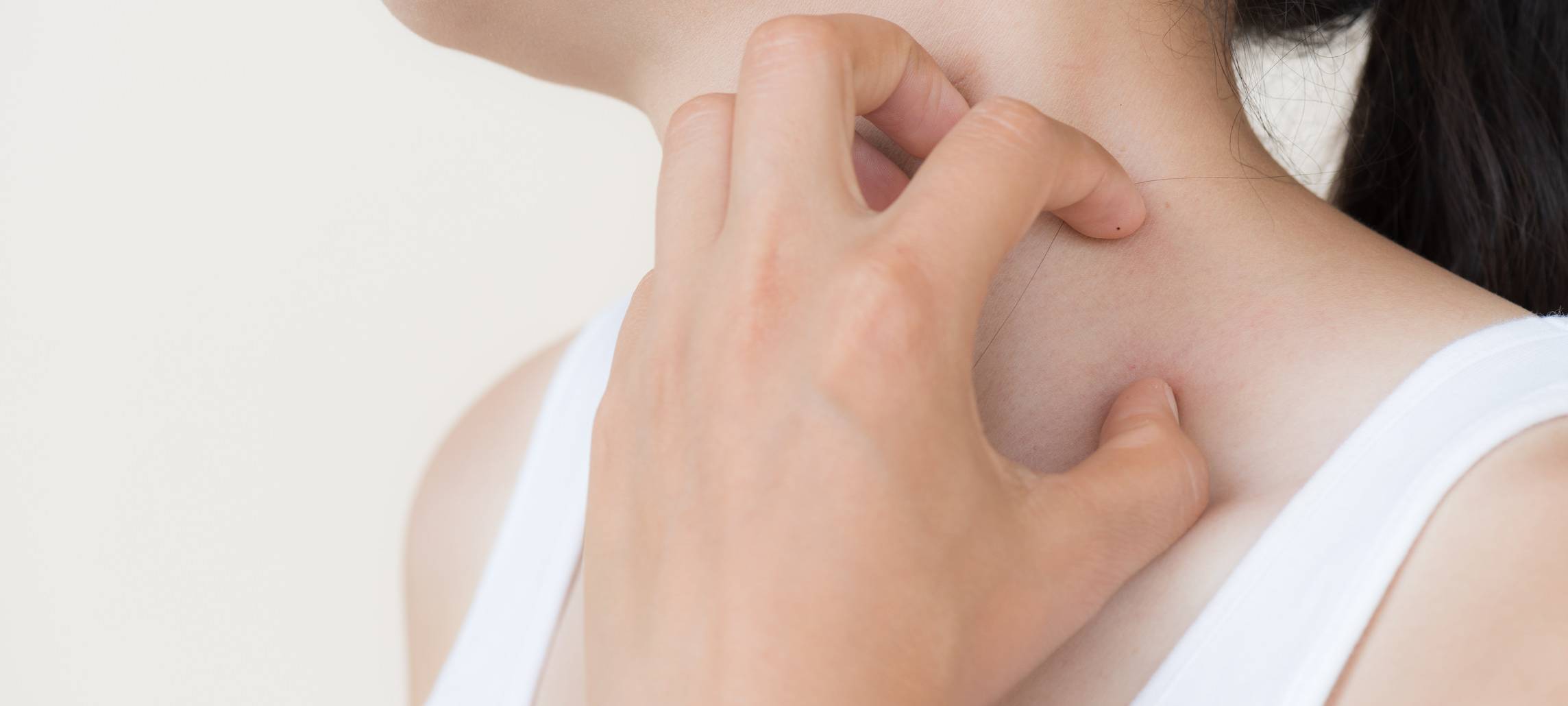 Weniger Krätze-Fälle im Kreis Recklinghausen