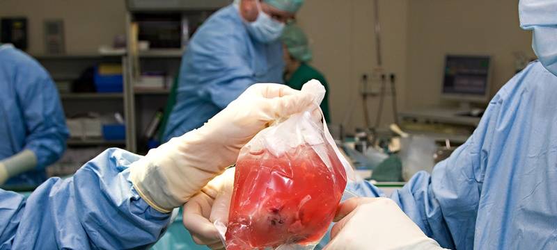 Organspende - ja oder nein?