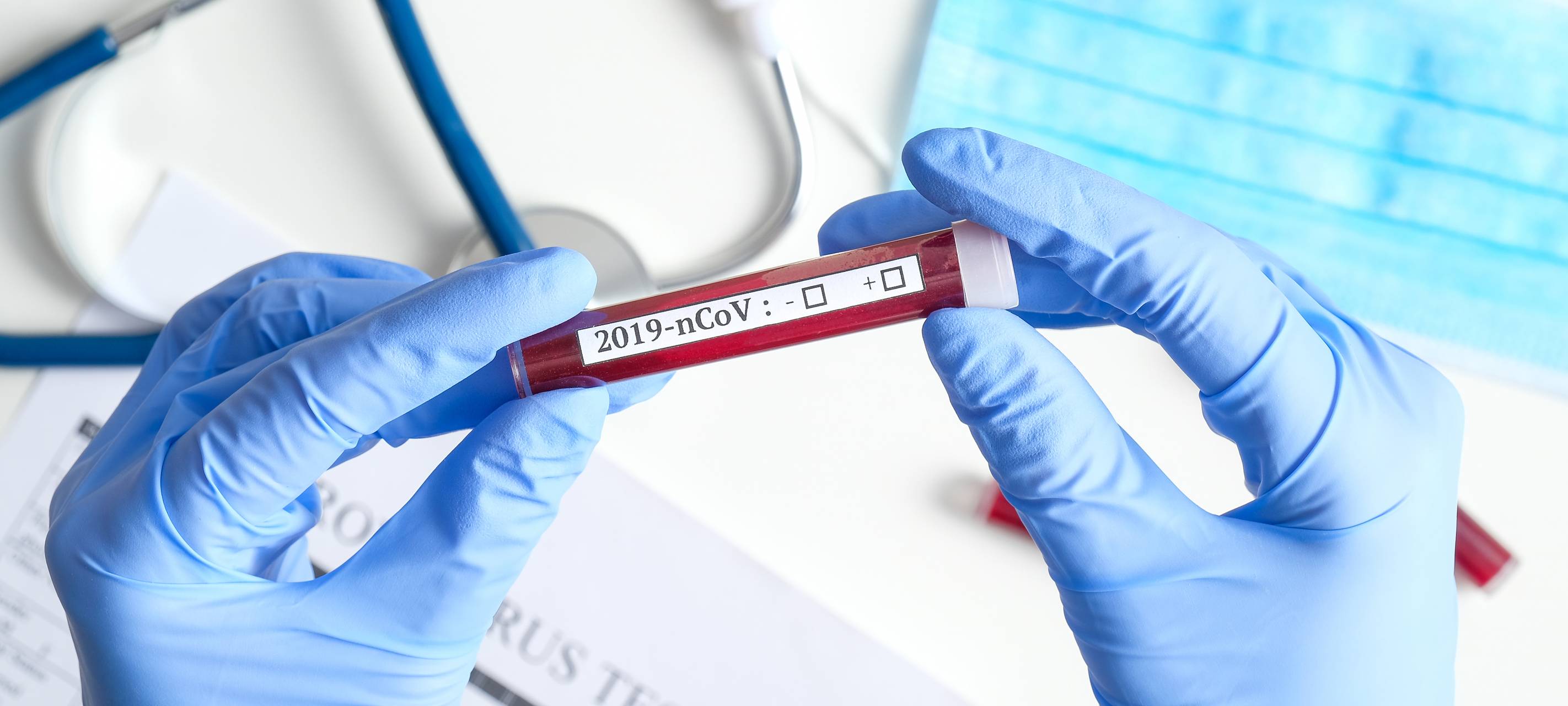 Ein Test für das Krankheitsbild des 2019-nCoV (Symbolbild).