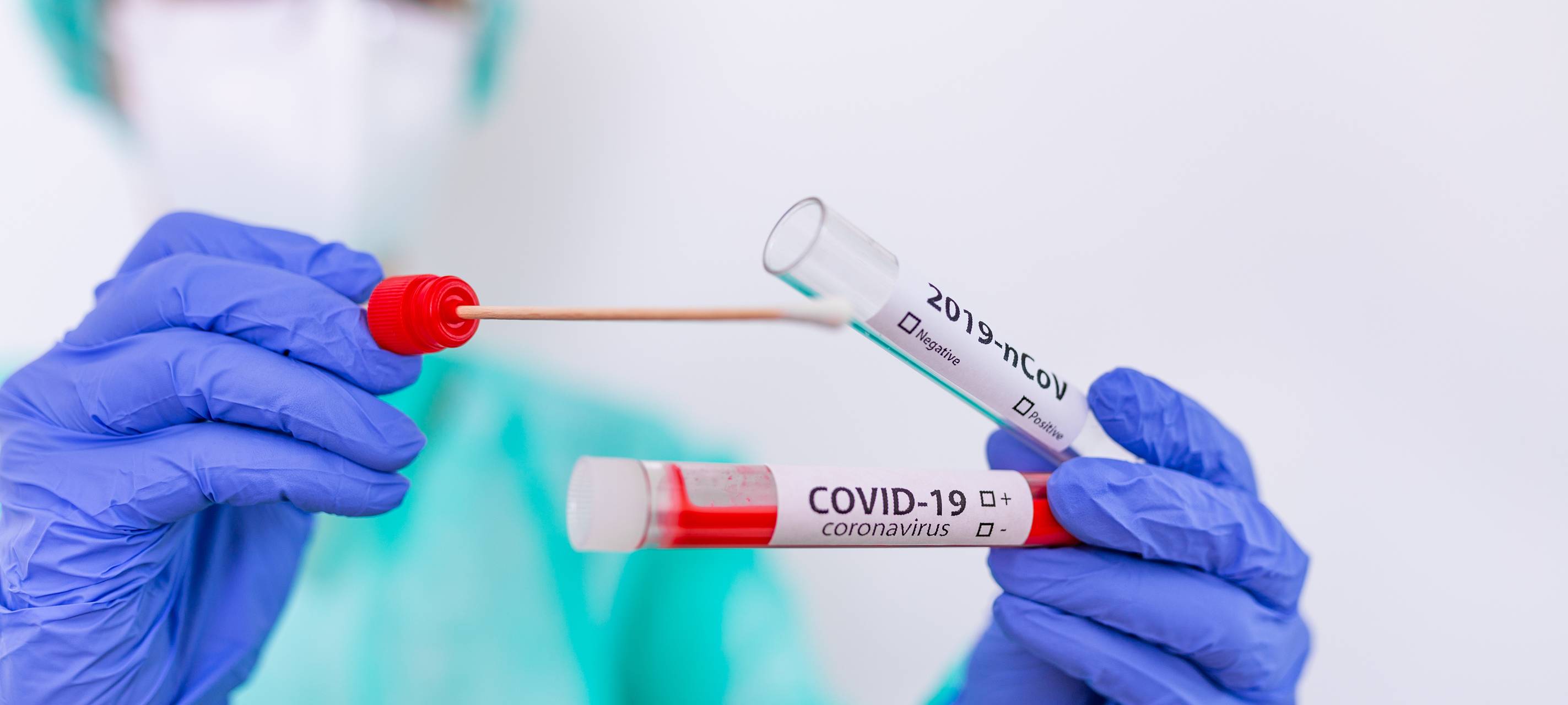 Covid Reagenzgläser Labor Test Corona