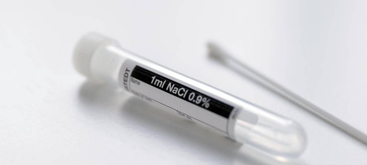 Weiteres Corona-Testzentrum im Kreis schließt