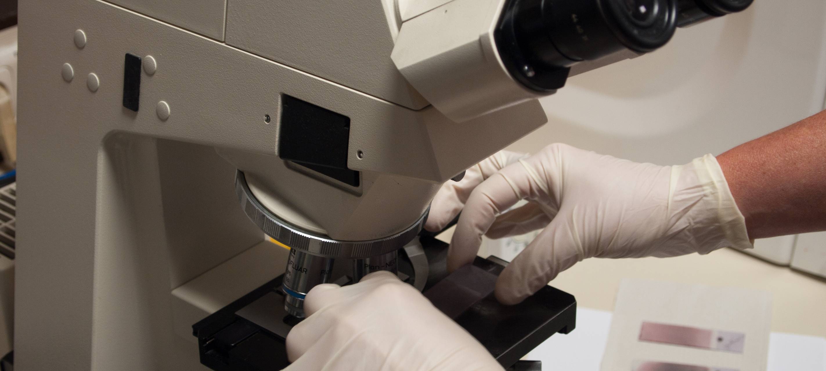 Giftige Stoffe in Brunnenwasser