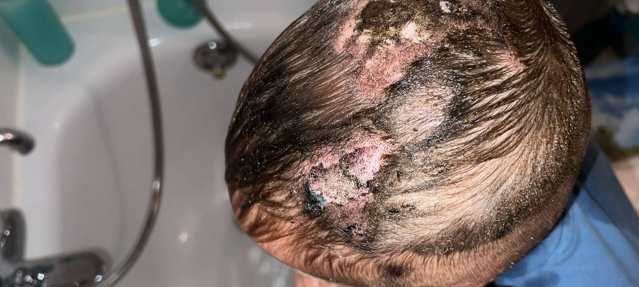 Marl: Schüler steckt Conner (7) Böller unter Fahrradhelm