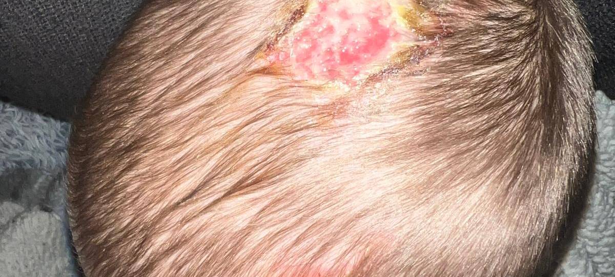 Marl: Schüler steckt Conner (7) Böller unter Fahrradhelm