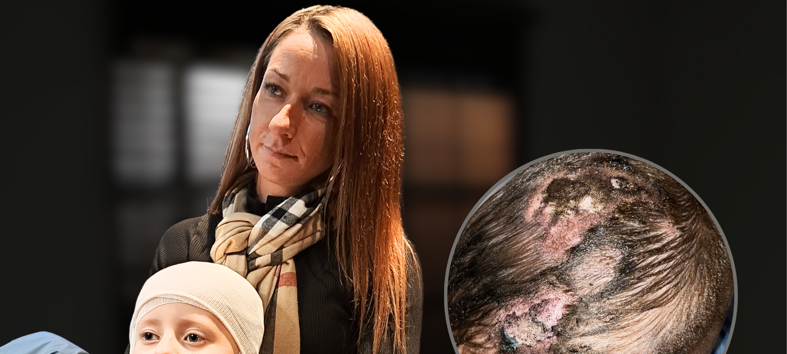 Marl: Schüler steckt Conner (7) Böller unter Fahrradhelm